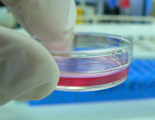 Cell culture in a petri dish. Photo via Flickr.
