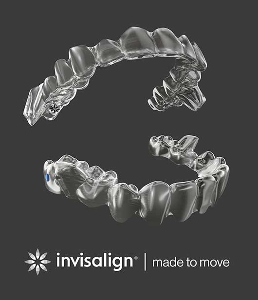 Invisalign treatment with mandibular advancement. Image via Align Technologies.