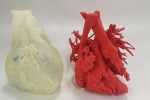 3D LifePrints rebrands as Insight Surgery and achieves second FDA clearance