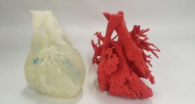 3D Lifeprints technology has been utilized in a range of medical applications including soft printed models to simulate operations (pictured). Photo via 3D Lifeprint.