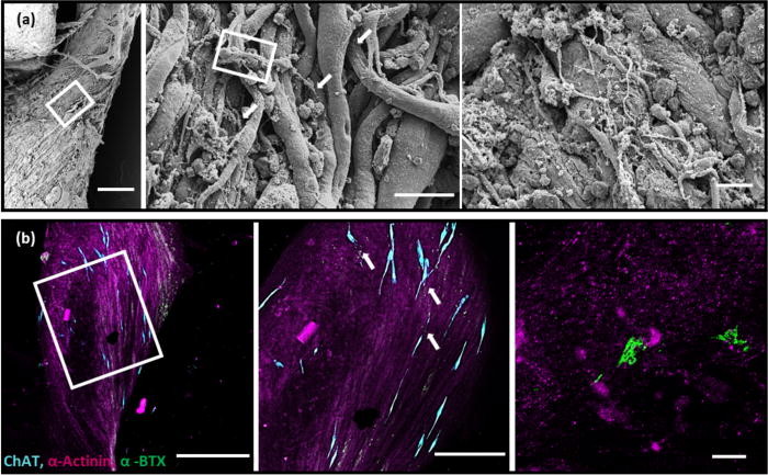 SEM images showing evidence of abutting cholinergic neurons and postsynaptic acetylcholine receptors. Photo via University of Illinois.