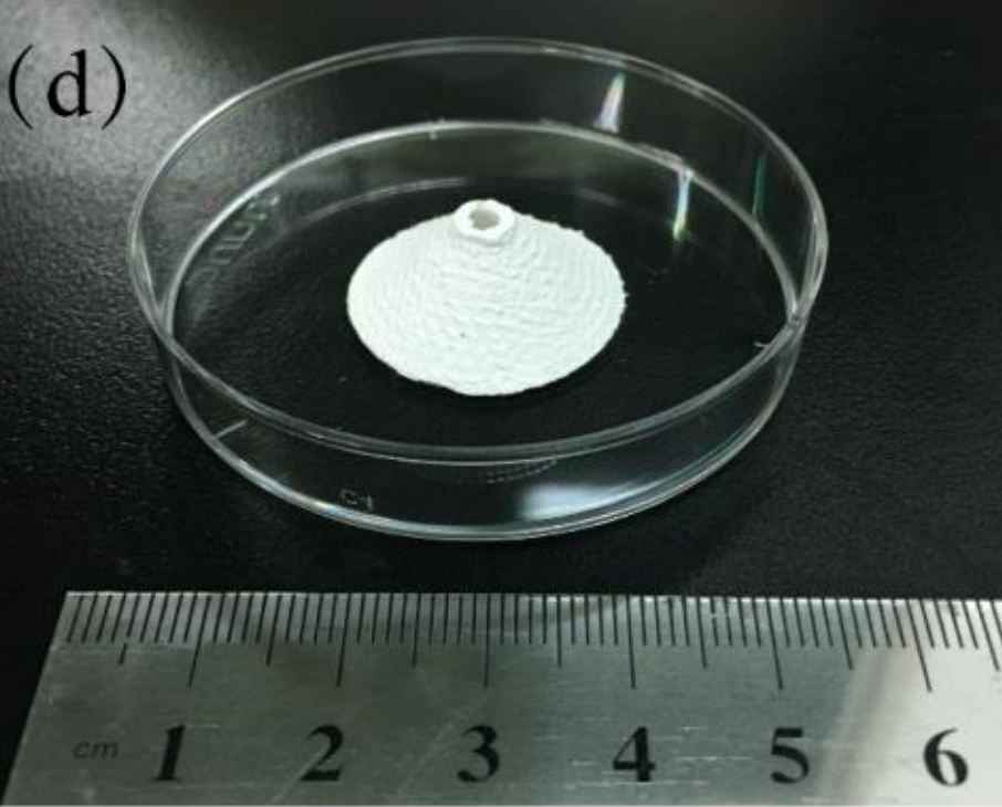The 3D printed cervix implant. Photo via Tsinghua University.