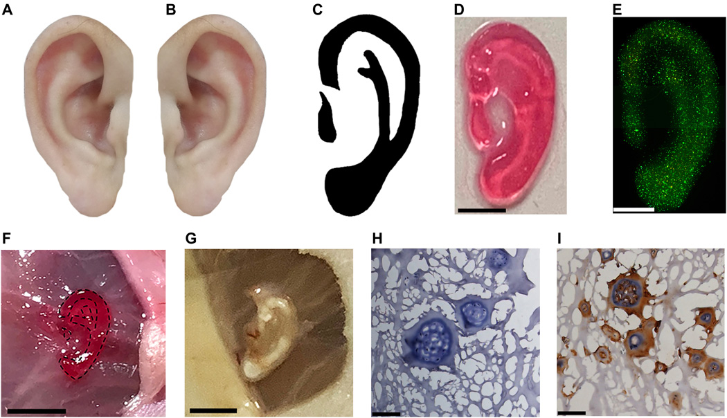 The researchers created a customized ear-shaped construct containing chondrocytes, which proved to be structurally stable after a full month. Image via Science Advances.