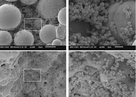 SEM imaging of the bacterial clusters on the implant. Image via Delft University of Technology.