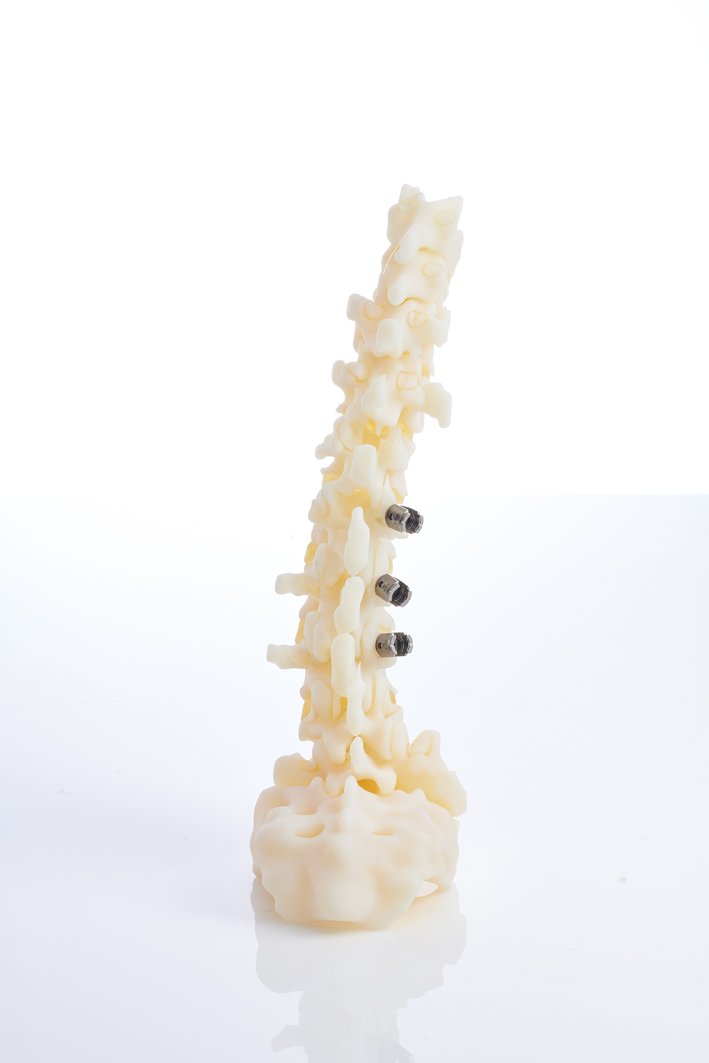 The Digital Anatomy 3D printer from Stratasys enables physicians to practice inserting screws for orthopedic applications with biomechanical realism similar to a human anatomy. Photo via Business Wire/Stratasys.