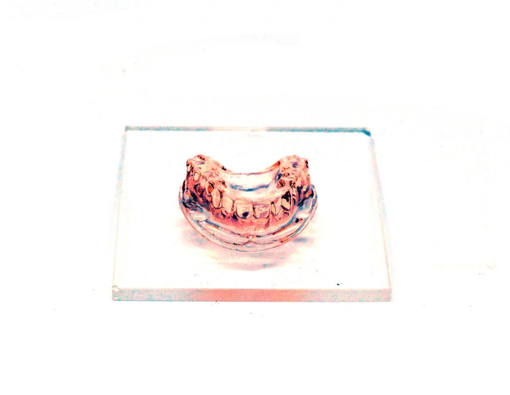 A dental mold 3D printed via xolography. Image via Dirk Radzinski/xolo.