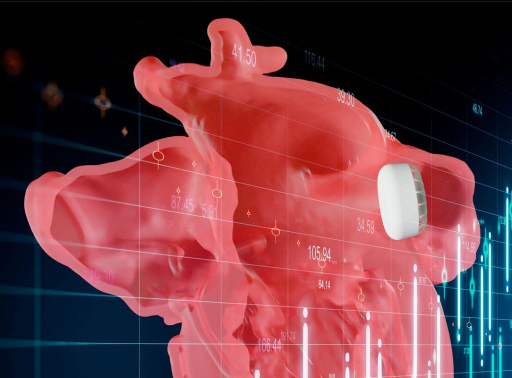 A LAAO device is used to regulate blood flow to the left atrium. Image via Materialise.