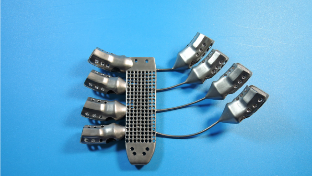 Australian medical device company Anotomics has previously 3D printed titanium rib implants. Photo via Anotomics.