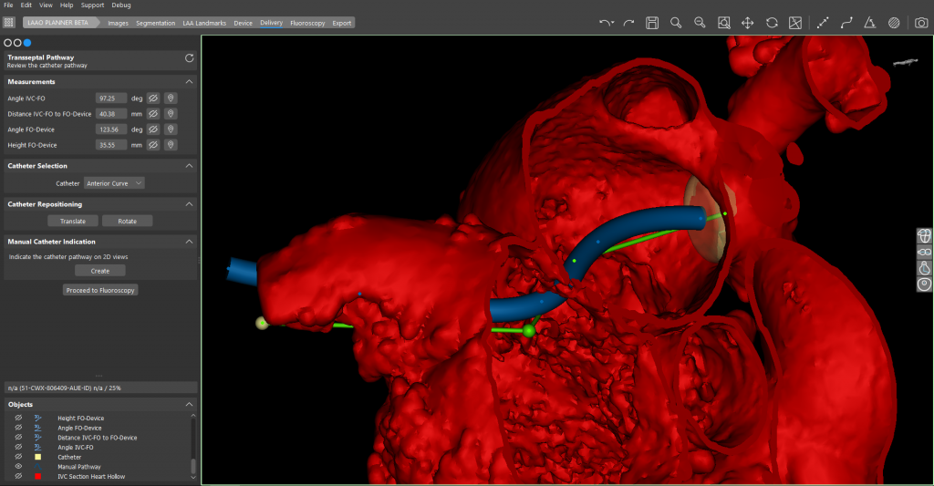 Inspecting a patient' 3D scan in Mimics Enlight. Image via Materialise.