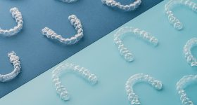 A batch of Prodways 3D printed dental aligners.