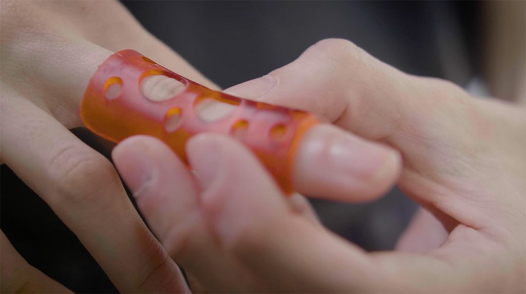 A 3D printed finger splint. Photo via B9Creations.