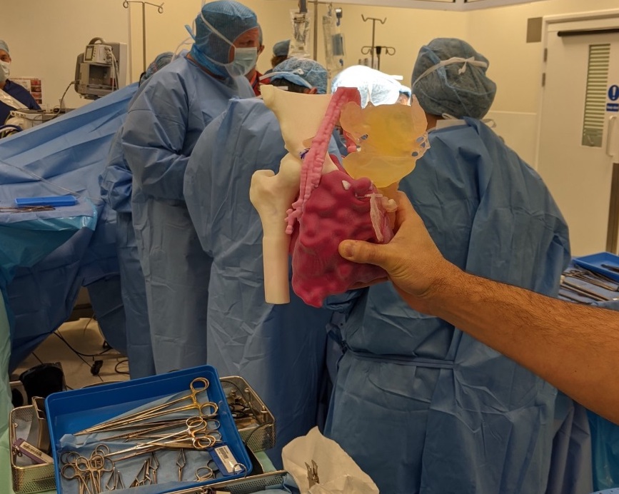 A surgeon holding a 3D LifePrints 3D printed cardiac model.