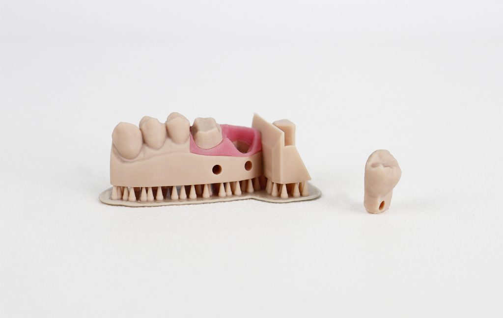 A partial model 3D printed using Liqcreate's Dental Model Pro Beige material.  