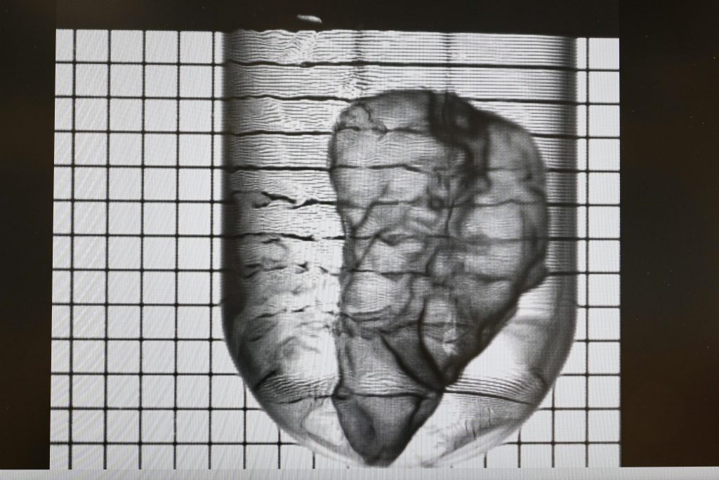 The mini 3D bioprinted pancreas. Image via EPFL / A. Herzog.