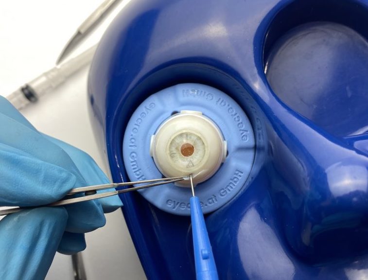 Eyecre's 3D printed eye model being operated upon. 