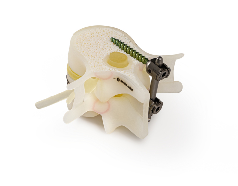 The J750 Digital Anatomy Printer can produce models that mimic the biomechanical properties of bone, vasculature, and organ tissues. Photo via Stratasys.