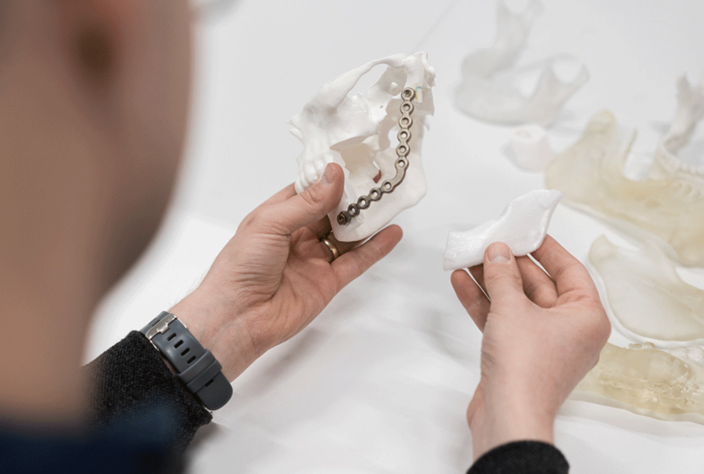 A 3D printed jaw model and bioresorbable implant.