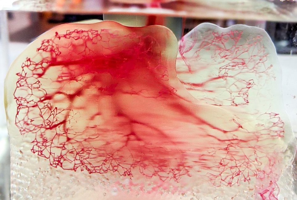 Modèle de système vasculaire humain créé à l'aide du processus Print to Perfusion de 3D Systems.  Image via United Therapeutics.