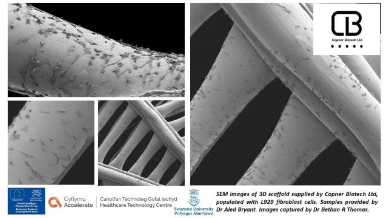 SEM images of 3D scaffold supplied by Copner Biotech populated with L929 fibroblast cells. Samples provided by Dr Alex Bryant. Image via Dr. Bethan R Thomas/Copner Biotech.