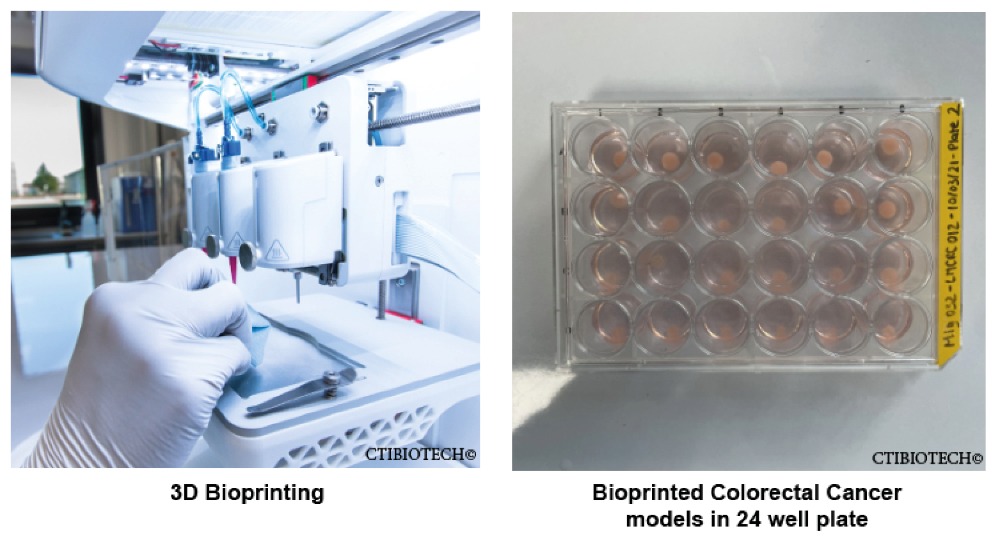 CTIBIOTECH's bioprinting platform develops cost-effective, robust, and reproducible colon cancer models. Image via CTIBIOTECH.