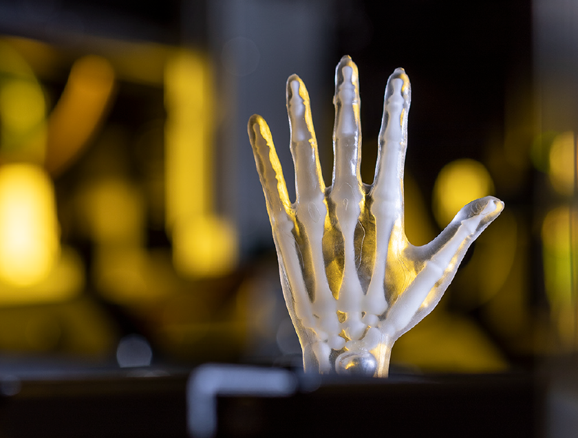 Xaar のプリントヘッドと高粘度液体を利用して 3Dプリントされた半透明造形物。半透明の人体の手の中に、白い骨がみえる。