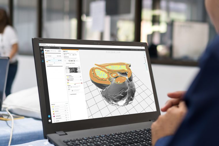 Digital Anatomy Creator allows users to advance the creation of functional medical models. Photo via Stratasys.