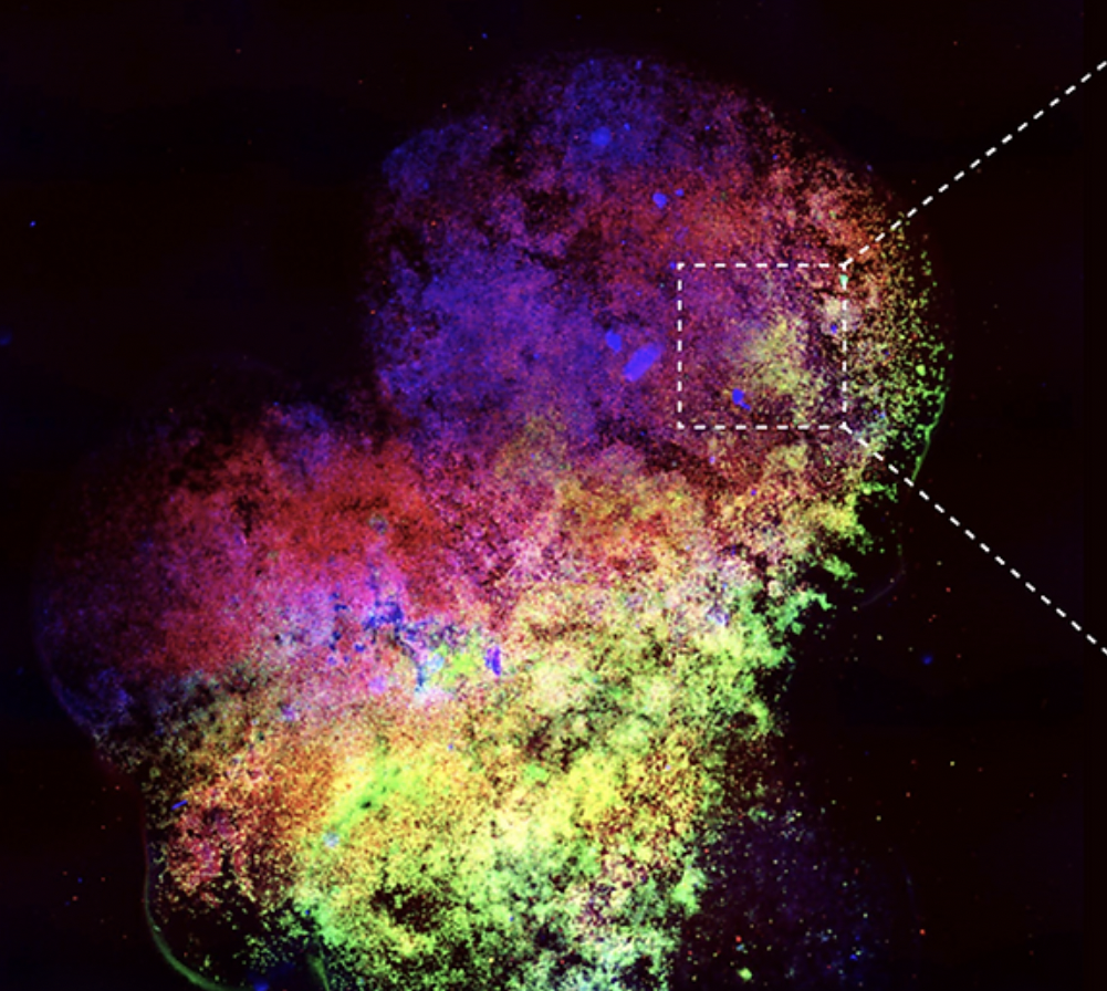 A high-resolution image of Prellis Biologics' 3D bioprinted Externalized Immune System.