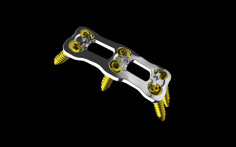 The Quantum Titanium Cervical Plate System. Image via Nvision Biomedical Technologies.