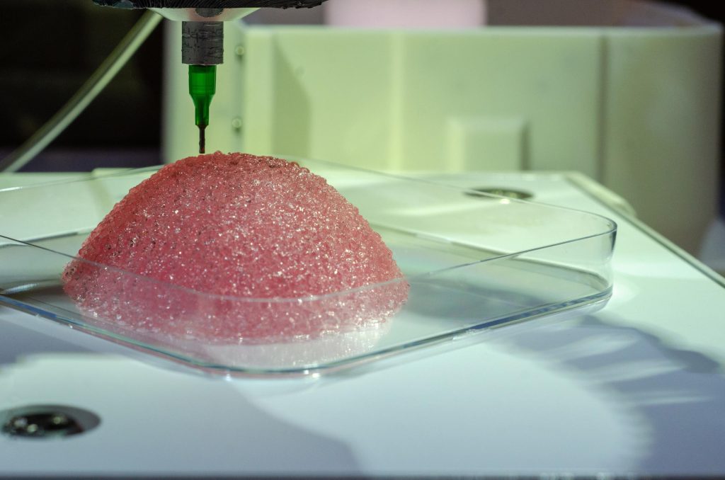 The bioprinted breast implants contain patient cells to improve graft success rates. Photo via Healshape.
