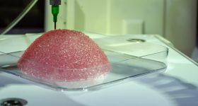 The bioprinted breast implants contain patient cells to improve graft success rates. Photo via Healshape.