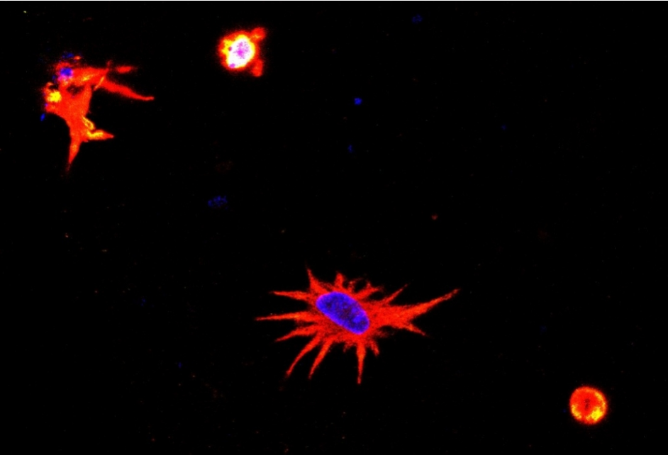 Morphology of a bioprinted astrocyte: cell nucleus stained blue and remainder stained red show a very similar state to that seen in neural tissue. Image via FAPESP.