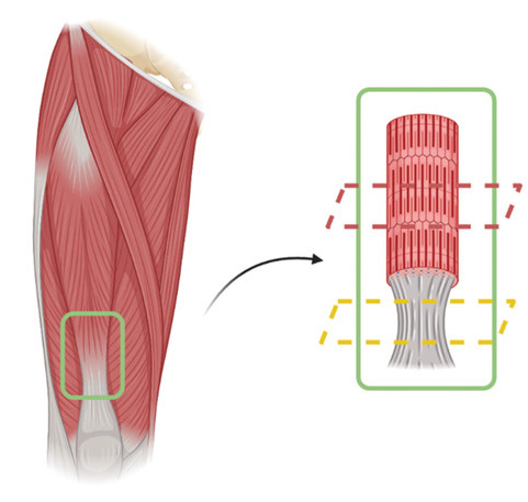 A diagram of the team's 3D bioprinted muscle-tendon structure.