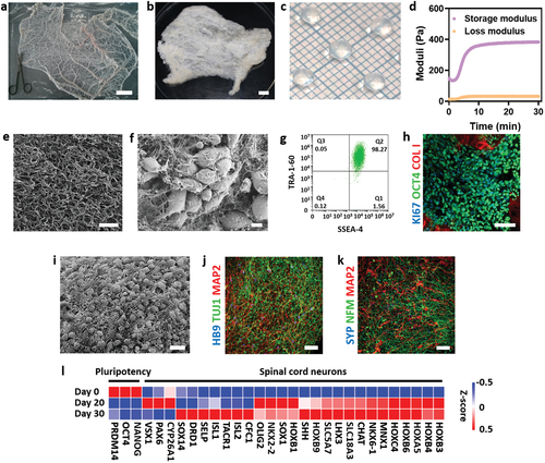 Generation and characterization of the spinal cord implants. Image via Matricelf.