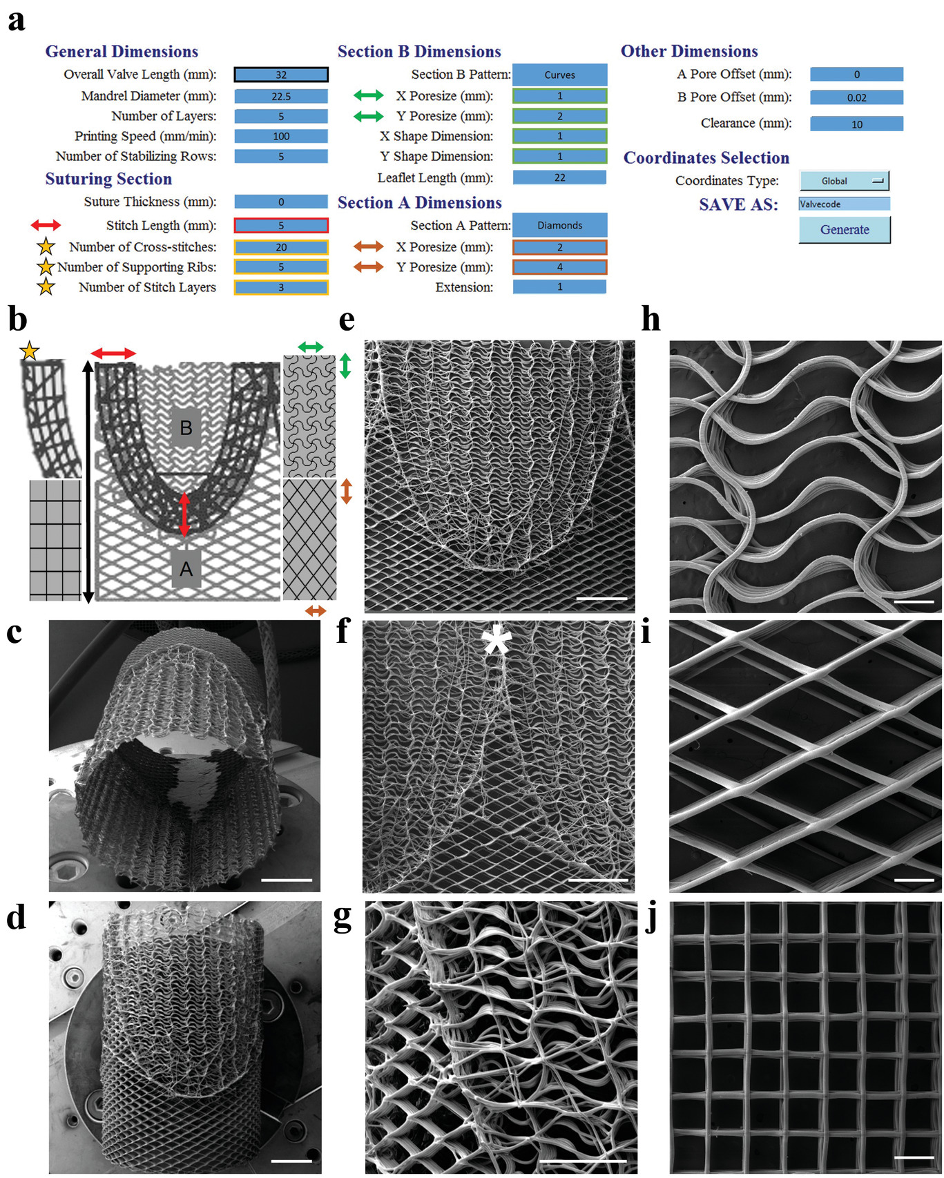 Design and fabrication of tubular, spatially heterogeneous scaffolds for heart valve tissue engineering. Image via Advanced Functional Materials.