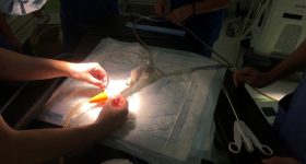 The 3D printed aorta model being used in real conditions in the operating room. Photo via 3Deus Dynamics.