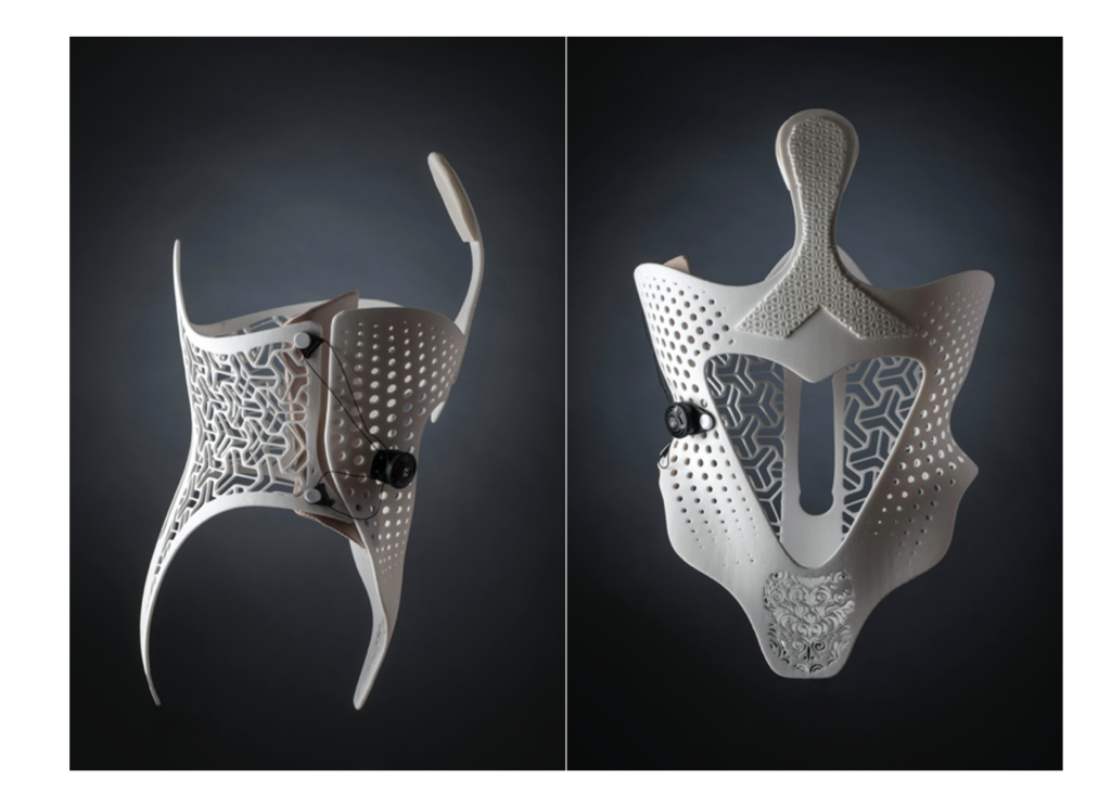 Sculpteo and Daniel Robert's 3D printed Orthosis. Images via Sculpteo. 
