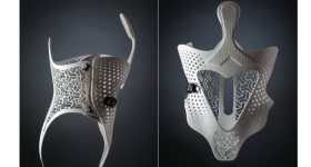Sculpteo and Daniel Robert's 3D printed Orthosis. Images via Sculpteo.