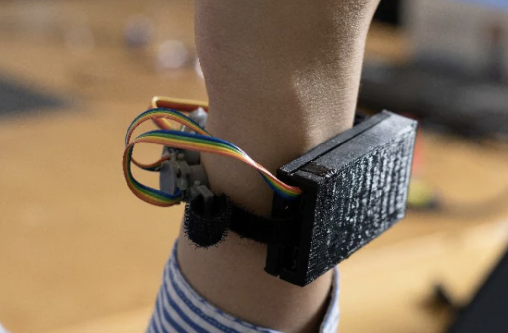 The University of Sydney's 3D printed sensor bracelet. Photo via the University of Sydney. 