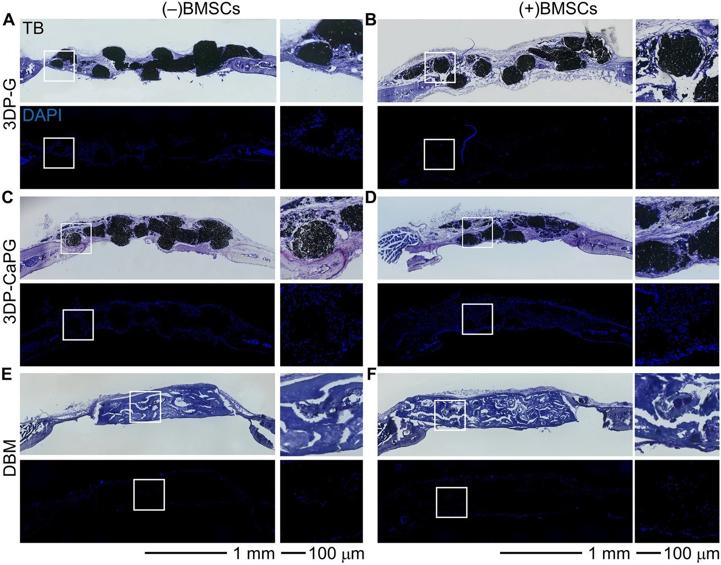 Biocompatibility of the matrices in a mouse calvarial defect model. Image via Nature.