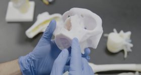 A 3D printed anatomic model via the Ricoh USA for Healthcare workflow. Photo via Ricoh USA.