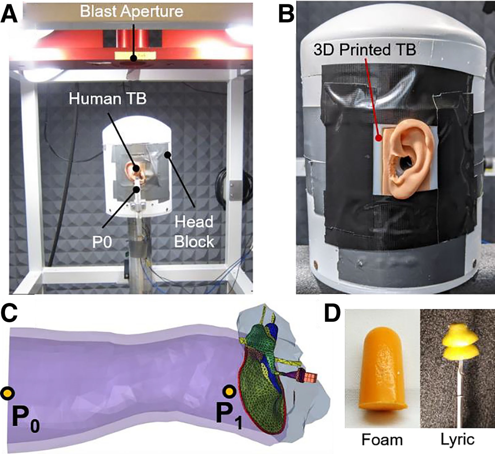 Configuration expérimentale du souffle et emplacements des capteurs de pression utilisés pour mesurer la transmission des ondes de souffle dans les modèles d'oreille imprimés en 3D.  Image via Otologie & Neurotologie Open.