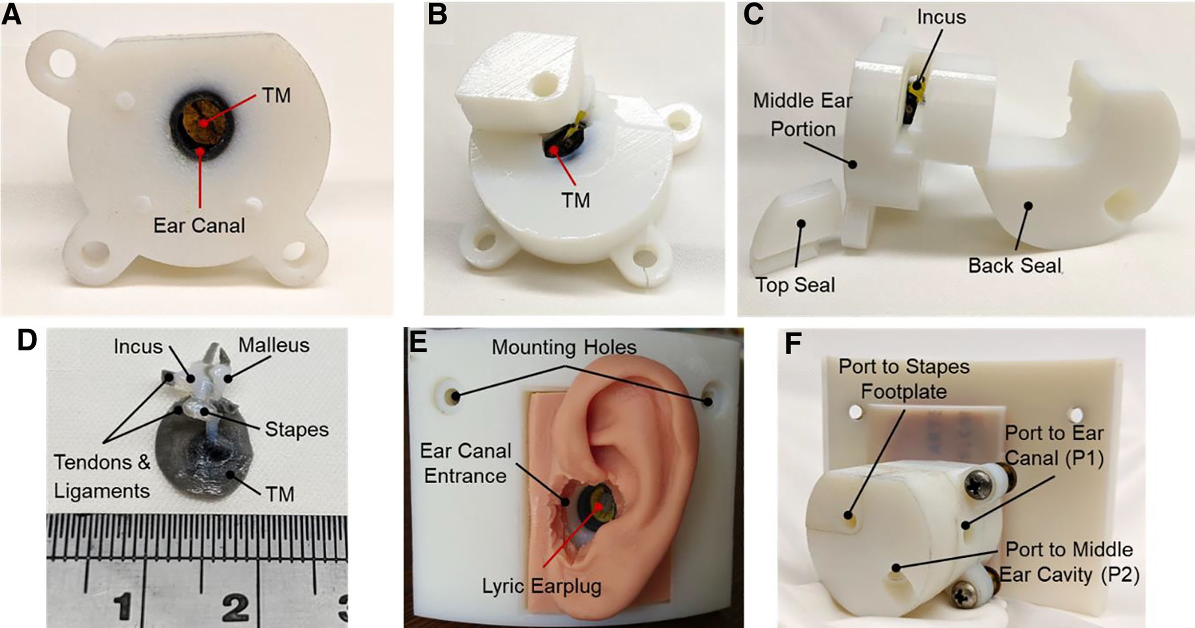 Images of a finished print of the 3D printed TB’s unassembled middle ear portion. Image via Otology & Neurotology Open.