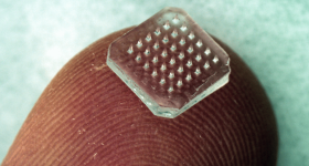 An example of a conventional microneedle patch. Photo via Georgia Tech.