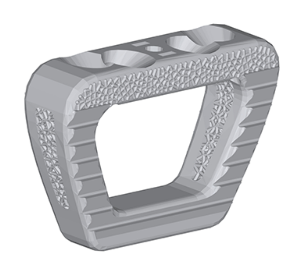 Spinal implant model defined using the 3MF Beam Lattice extension. Image via MachineWorks.
