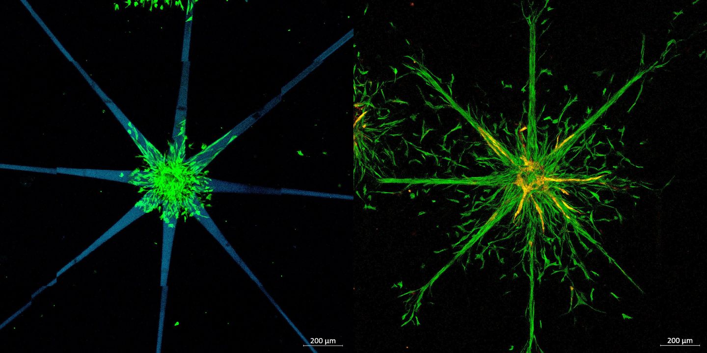 Leveraging their multi-photon lithography process, the researchers created star shaped patterns (left), into which the cells can grow (right). Image via TU Wien.