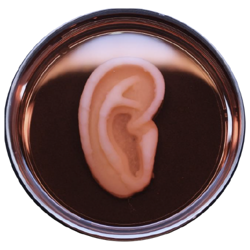 A 3D printed AuriNovo “living” ear for reconstruction in Microtia patients. Photo via 3DBio Therapeutics.