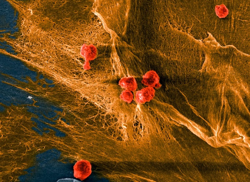 Une image micrographique du composite biohybride de l'équipe, avec des cellules (rouges) ensemencées sur les domaines fibreux (jaunes) du collagène.  Image via l'Université Cornell. 