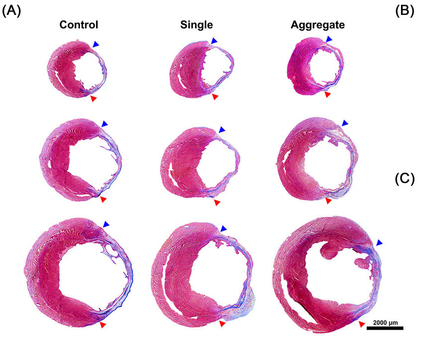 Imaging showing cardiac fibrosis in spheroid samples after 8 weeks. Image via T&R Biofab. 