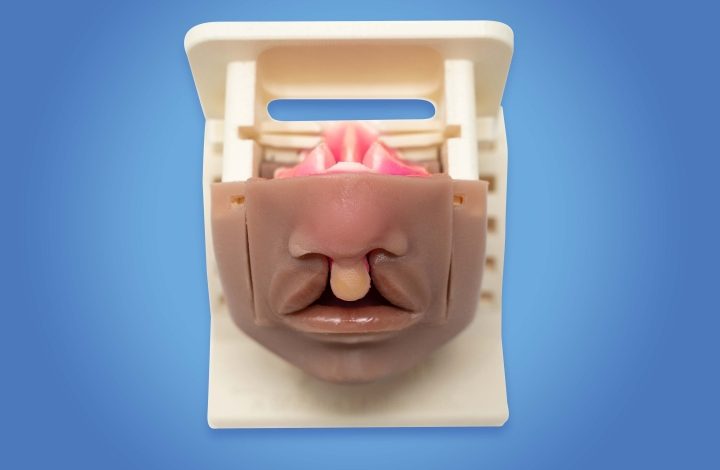 The 3D printed cleft lip simulator. Photo via Simulare Medical.
