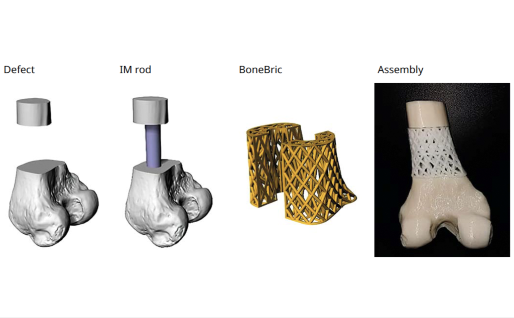 Un diagramme indiquant comment le BoneBric imprimé en 3D de BellaSeno peut être appliqué.  Image via BellaSeno. 